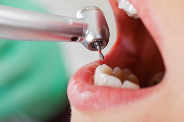 Best Emergency Treatment for Dental Infections or Abscesses in Flat Rock, MI